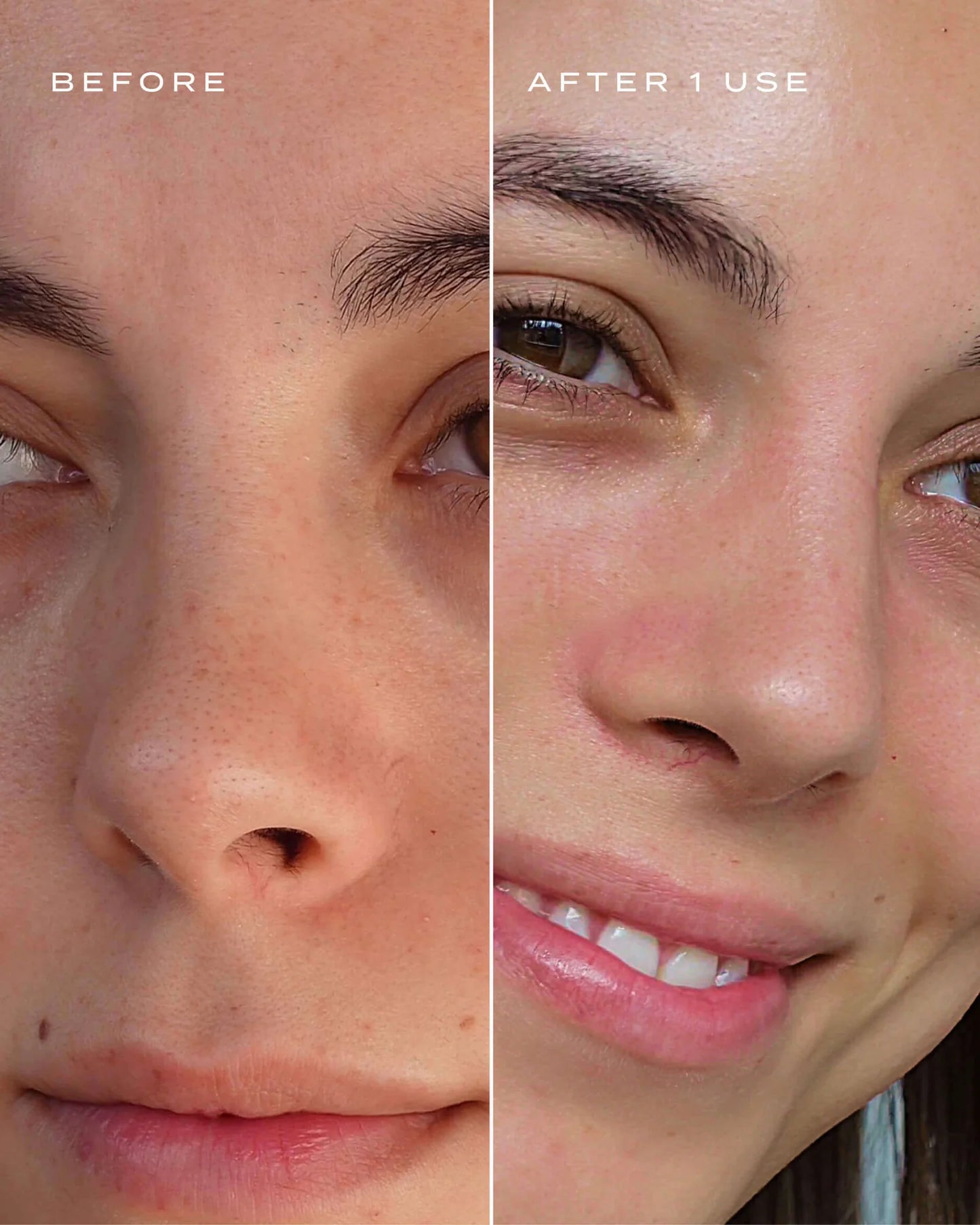 HYDROSKIN+ NOSE PATCHES